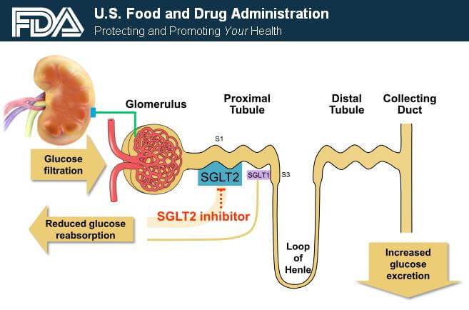 Diabetes Drug SGLT2 Inhibitor Mechanism from FDA